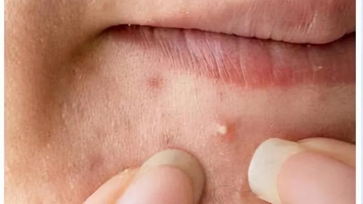 男人不护肤怎么补救呢,男人不护肤怎么办