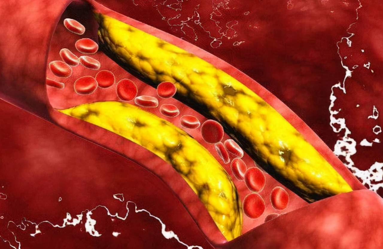 你有清洗“肛门”的习惯吗？能给人带来哪些好处？本文带你了解