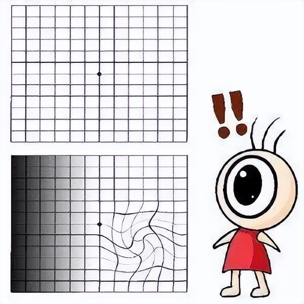 怎么预防老年黄斑病变,什么是黄斑变性怎样预防和治疗