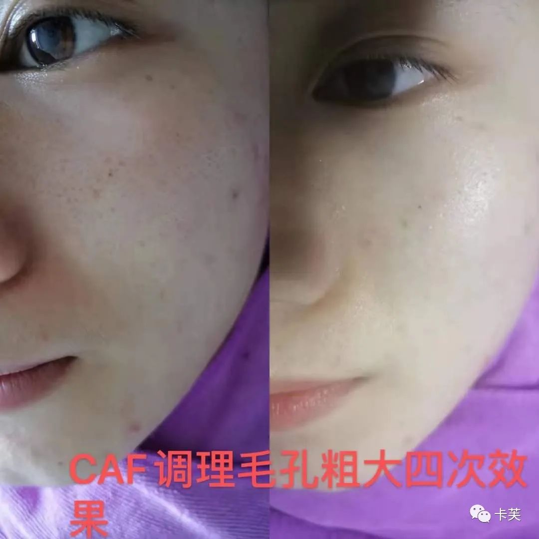 地龙多肽多效美肤霜，赋予你应有的健康、美丽与自信