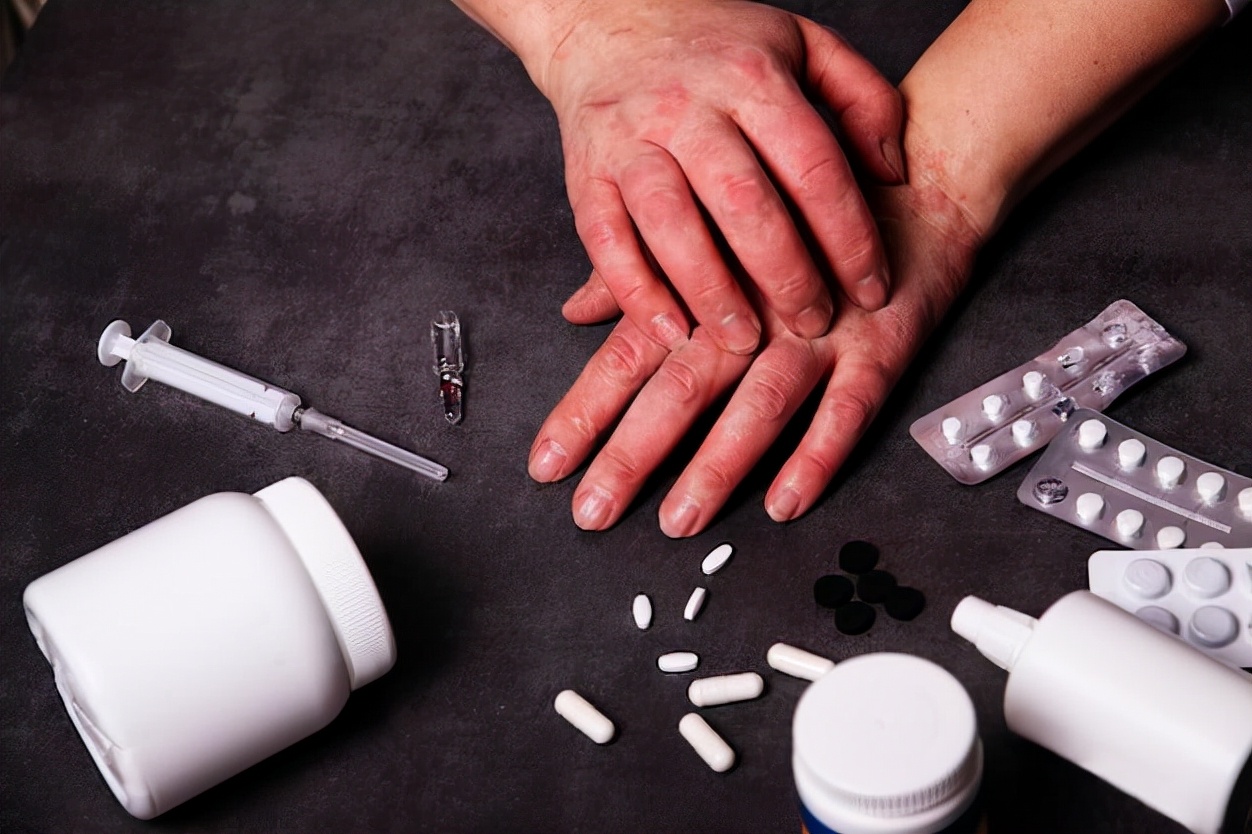 耳朵湿疹流黄水反复发作怎么除根,湿疹反复发作如何断根