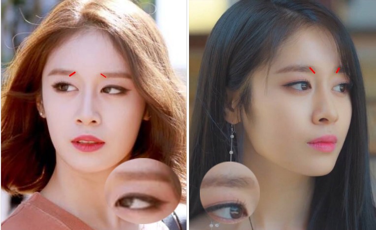 眉毛不对称怎么办可以整容吗,脸圆眉毛淡怎么修剪