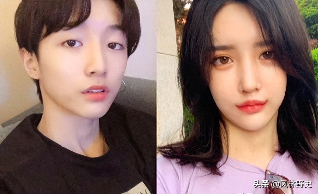 网红变性后遗症,网红变性36天痊愈