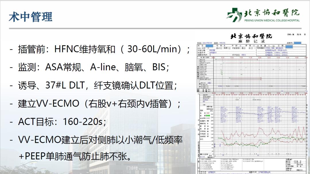 ecmo体外人工膜肺ppt,vv-ecmo怎么用