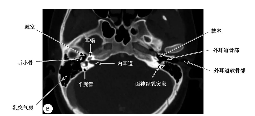 耳部解剖结构和生理功能,耳部解剖笔记