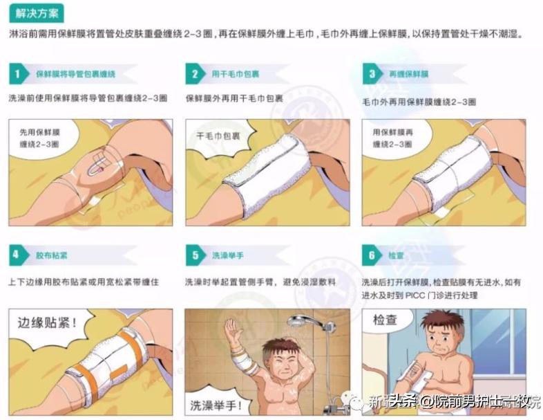 picc置管技术大全,picc置管操作流程