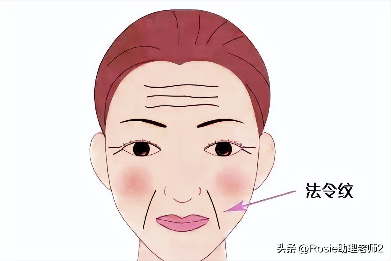 黎姿的下巴怎么改善的,黎姿面部变化