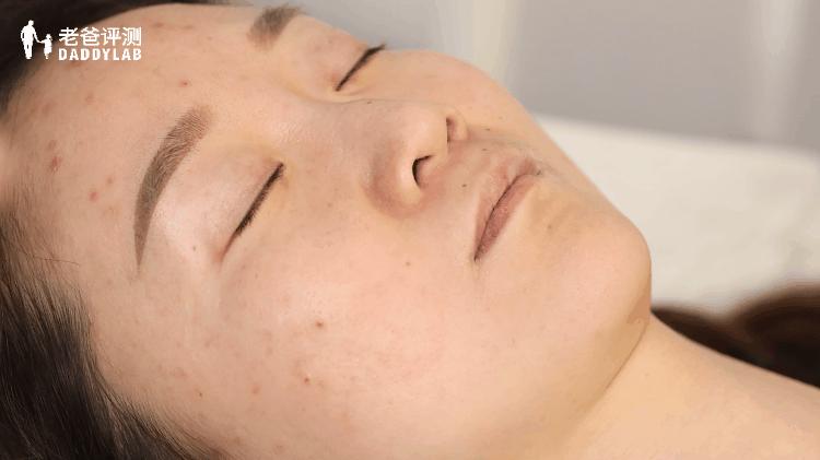 美白精华真人28天实测,真人实测28天冻龄瓶精华测评来啦