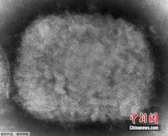 关于猴痘，你最关心的10个问题有答案了→