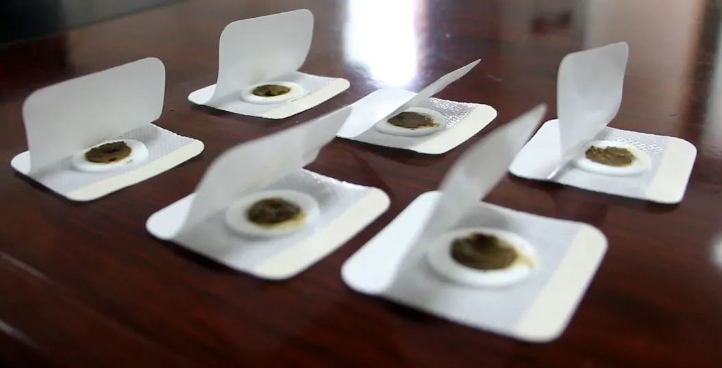 耳鼻喉科穴位贴,耳鼻喉科的三伏贴和儿科三伏贴