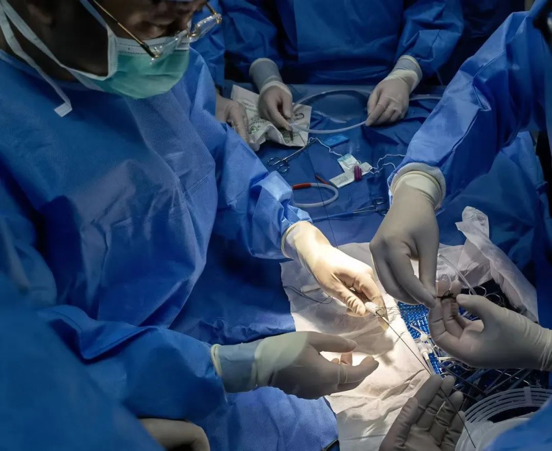 男子因修脚截肢,脚下鸡眼剪破了一直不好