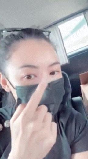 张柏芝手臂伤疤被曝照片,张柏芝被自家宠物狗咬伤视频