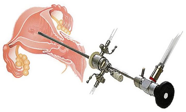 宫腔镜医学科普类视频模板,医院妇科科普创意视频