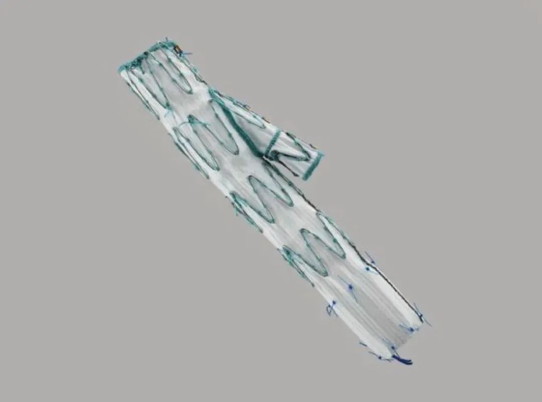 髂动脉支架植入视频,髂动脉夹层支架植入视频