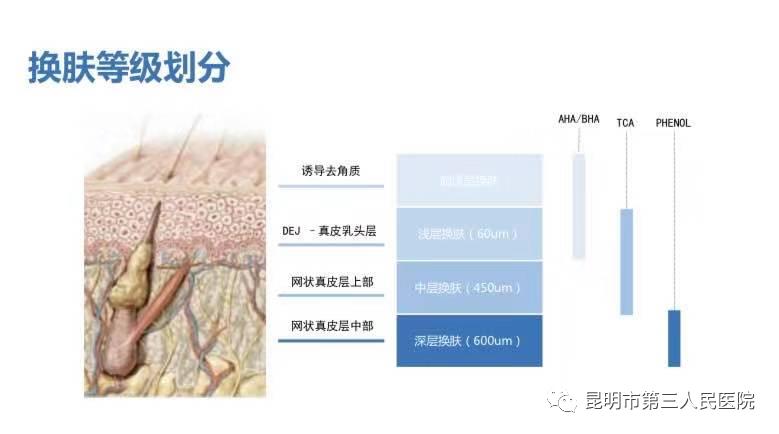 超甜礼遇“6·18”！昆明市三院皮肤科化学换肤术活动来袭