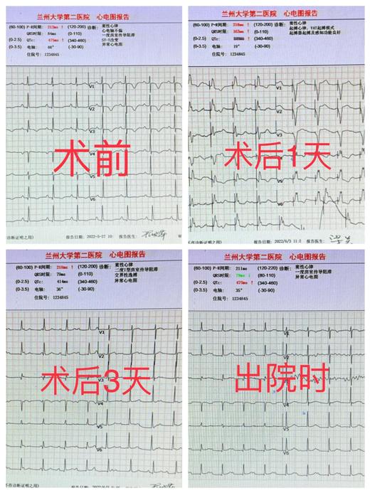 兰大二院心脏科,兰大二院心脏外科