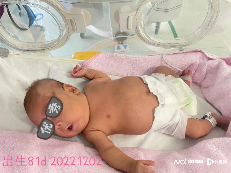 医院抢救26周早产儿后续,深圳早存活的早产儿