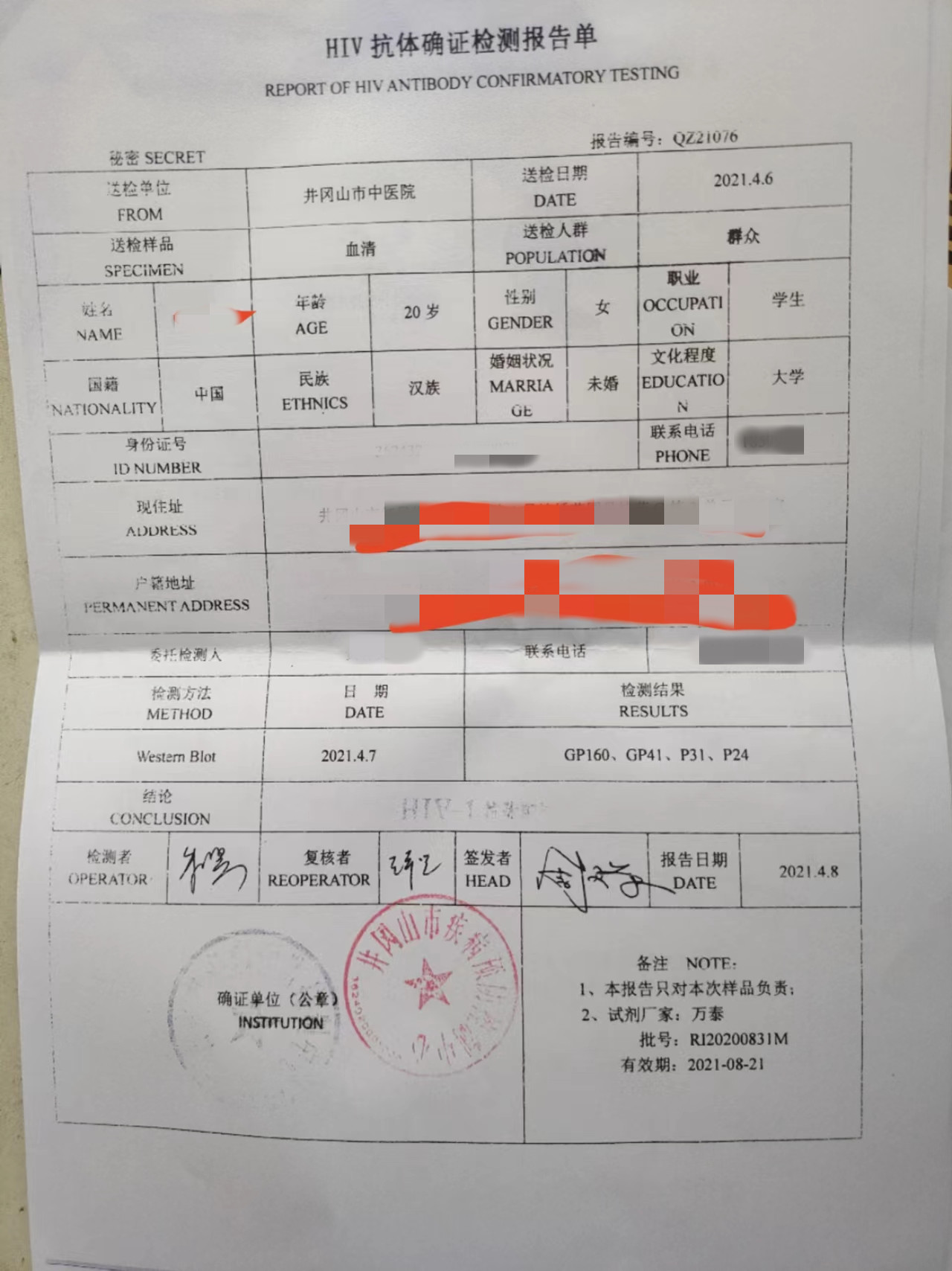 一女大学生查出艾滋病,江西大二女生艾滋病