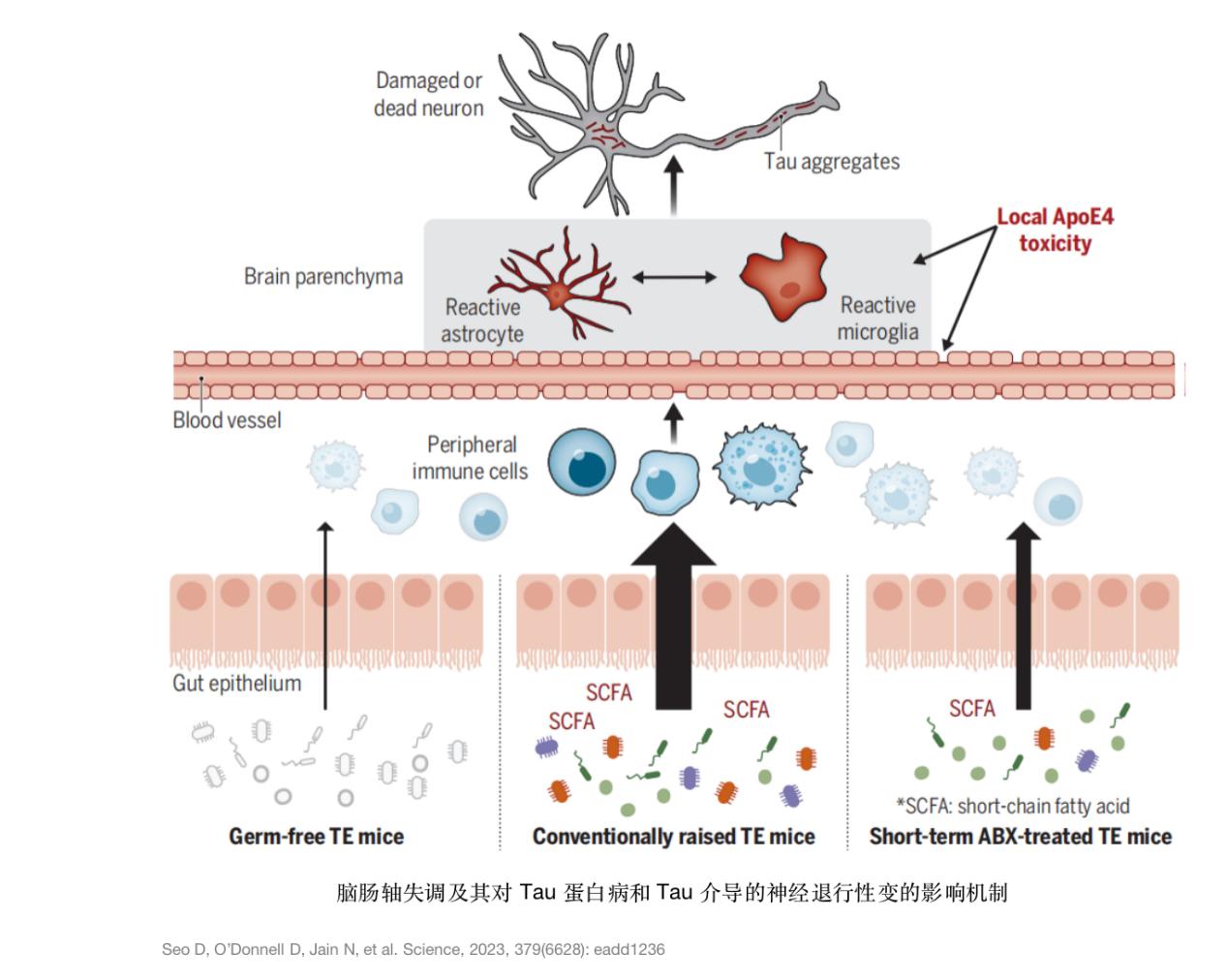阿尔茨海默病研究获重大突破,临床研究证实,调节肠道菌群有望治疗神经退行性疾病