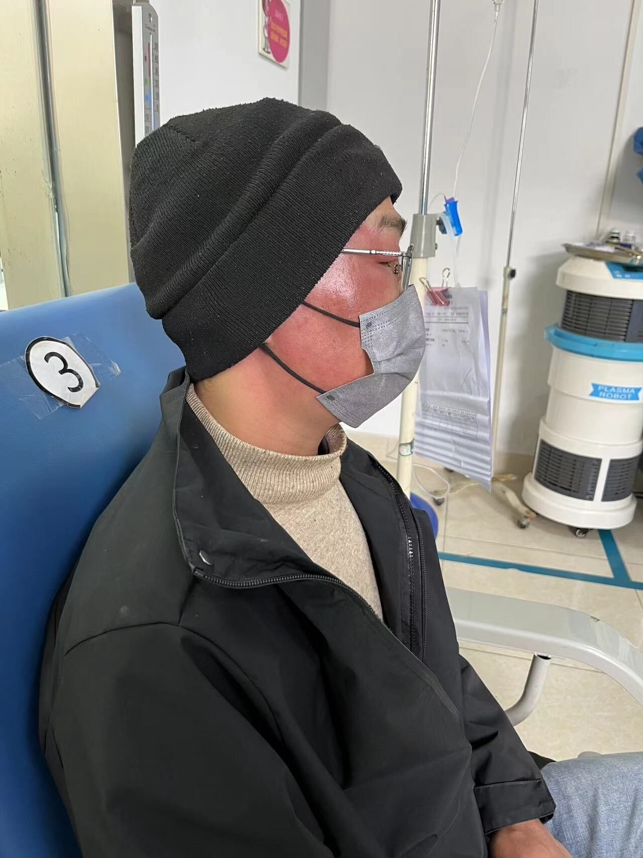 剃须刀刮破皮是否导致须疮,剃须刀划破皮肤会不会传染疾病