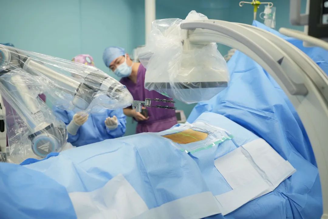 智能多功能骨科手术机器人,智慧微创骨科